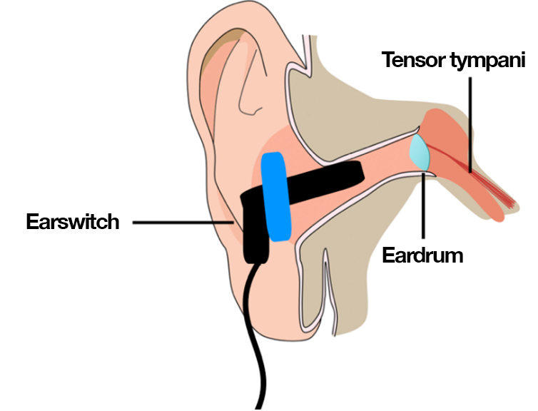 A diagram of the human ear, with the Earswitch bud, eardrum, and tensor tympani located and market using text.