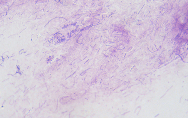 Actinomyces sp. mixed infection peritonitis in a cat