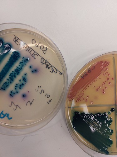 La carrera científica contra las bacterias multirresistentes