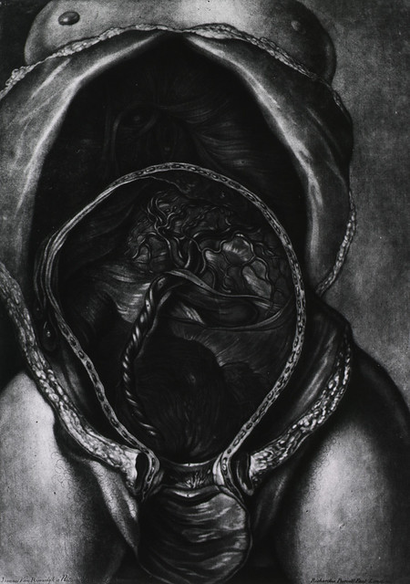 Uterus After Birth with Placenta Attached