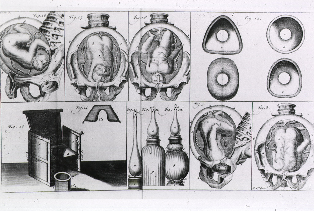 Various Positions of Fetus in Utero