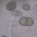 Calicum abietinum, EBP#4640 EBP#4640, 1000x