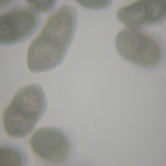 Calicum abietinum, EBP#4640 EBP#4640, 1000x