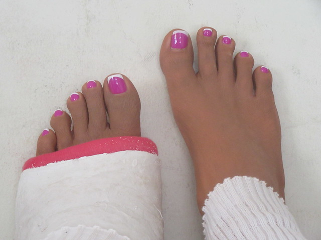 Barefoot Broken