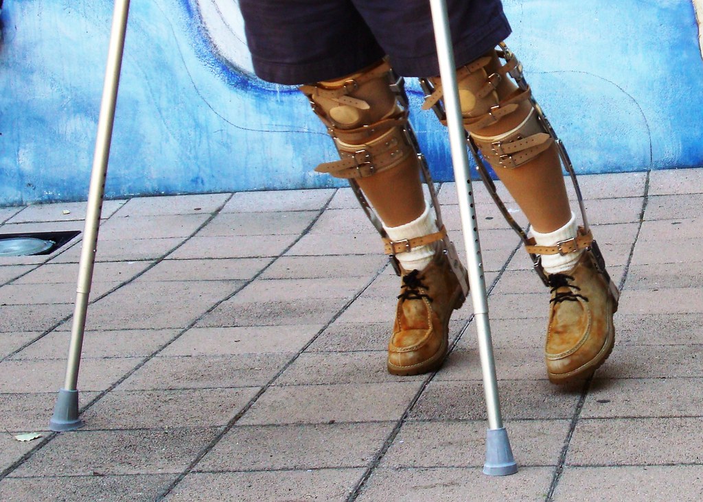 Crutches and swinging leg braces, Seeing a swing-thru gait …