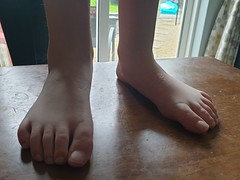 Inherited Toes