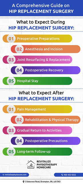 comprehensive-guide-on-hip-replacement-surgery