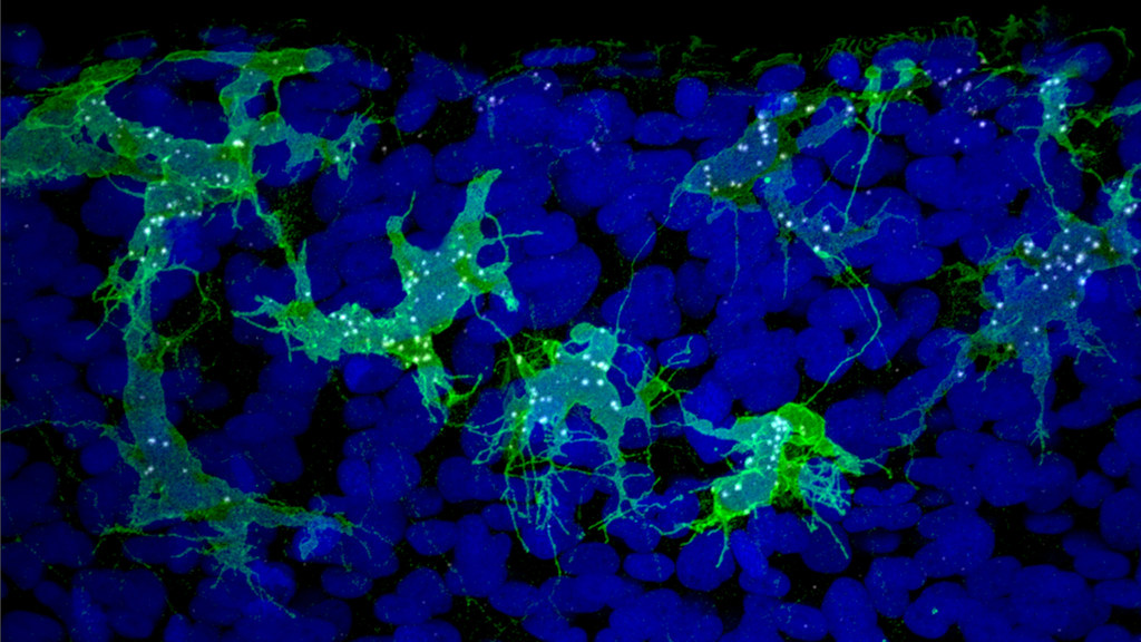 Zebrafish neural crest cells