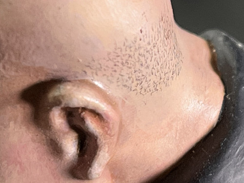 3D Printed 'Face Palm' Pickard - Head Fuzz