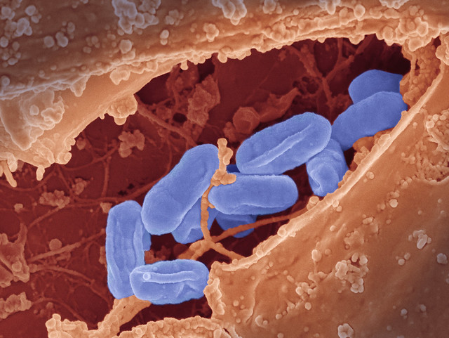 Rickettsia typhi Bacteria