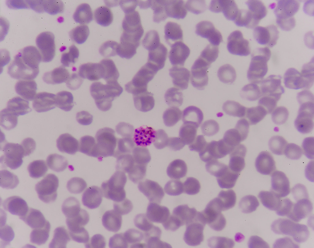 malaria parasite in blood.