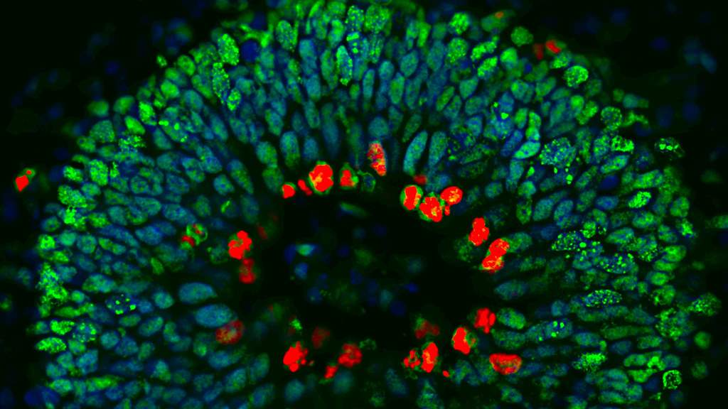 Image of brain tissue with parts lit up