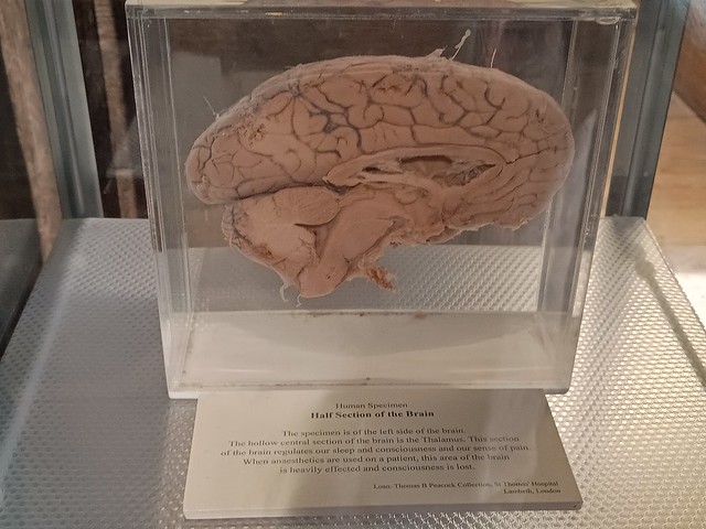 UK - London - London Bridge - Old Operating Theatre Museum & Herb Garret - Herb garret - Half section of the brain