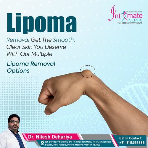 Best Lipoma Surgeon In Indore - Intimate Clinic