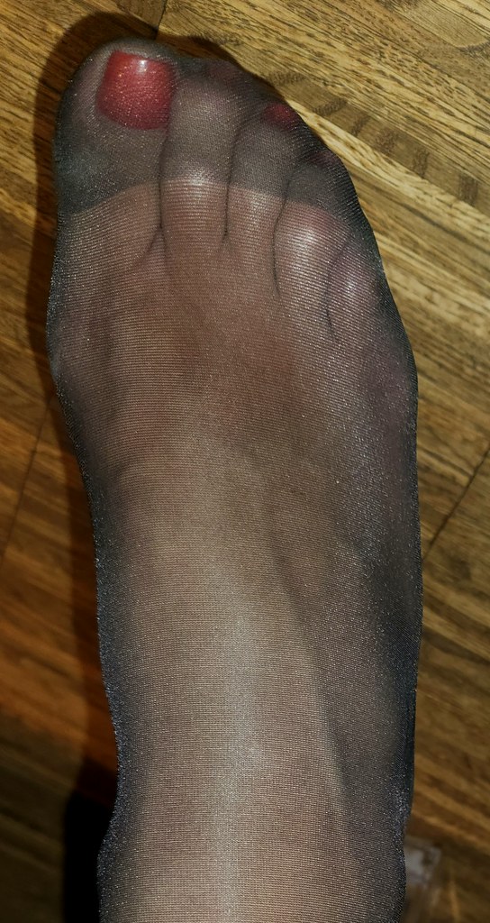foot shaped from wearing pointed pumps