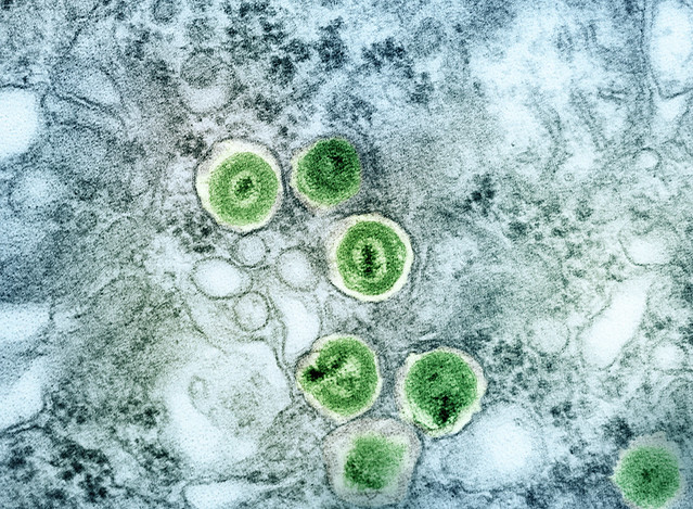 Cytomegalovirus (CMV) Particles