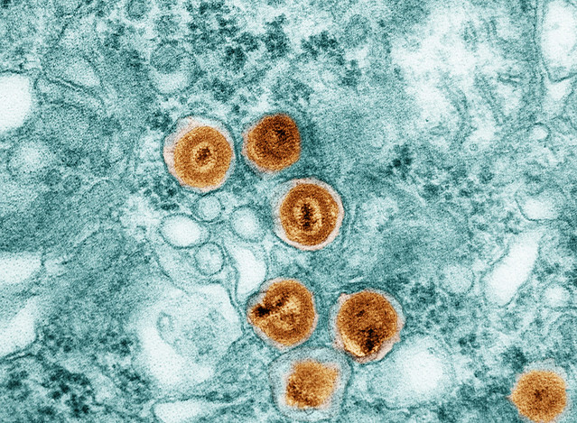 Cytomegalovirus (CMV) Particles