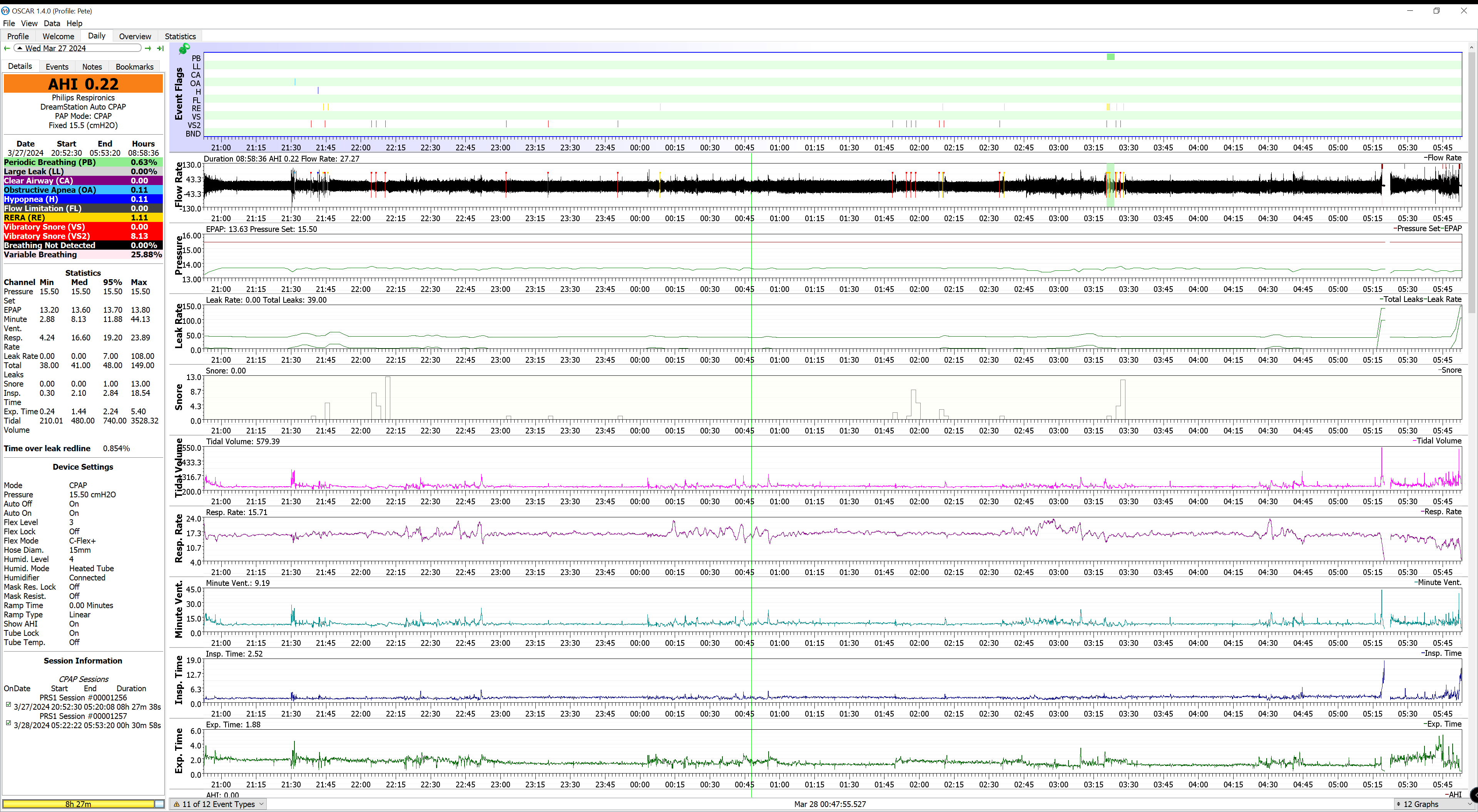 CPAP “Central AI” : r/CPAP