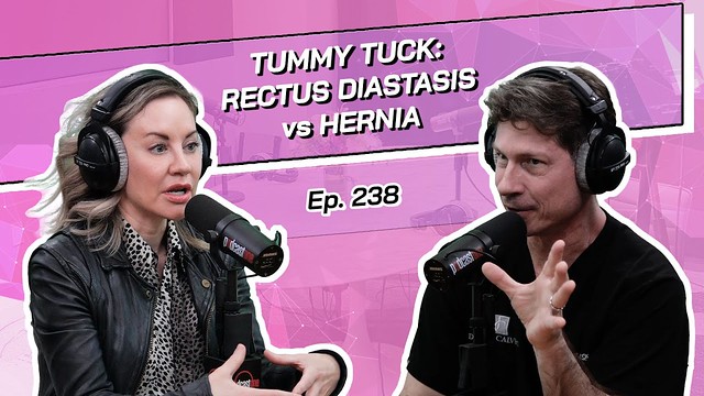 Tummy Tuck: Rectus Diastasis vs Hernia - The Beverly Hills Plastic Surgery Podcast with Dr. Jay Calvert