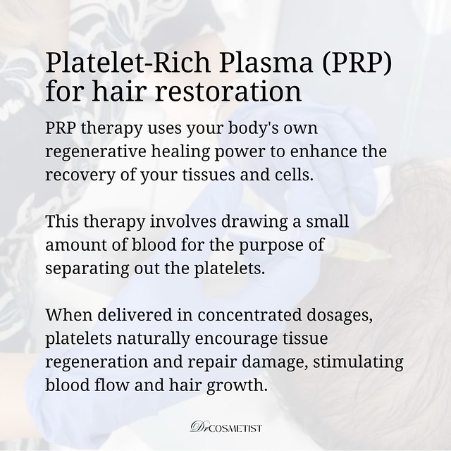 Platelet-rich Plasma (PRP) 2