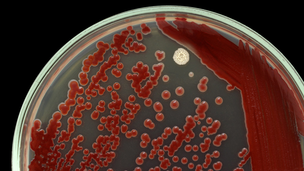 Bacterial colonies growing in a petri dish