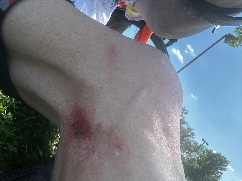 Tire Machine Rash IMG_7415 | Front tire blow out equals a few road rash spots!β¦ | Flickr