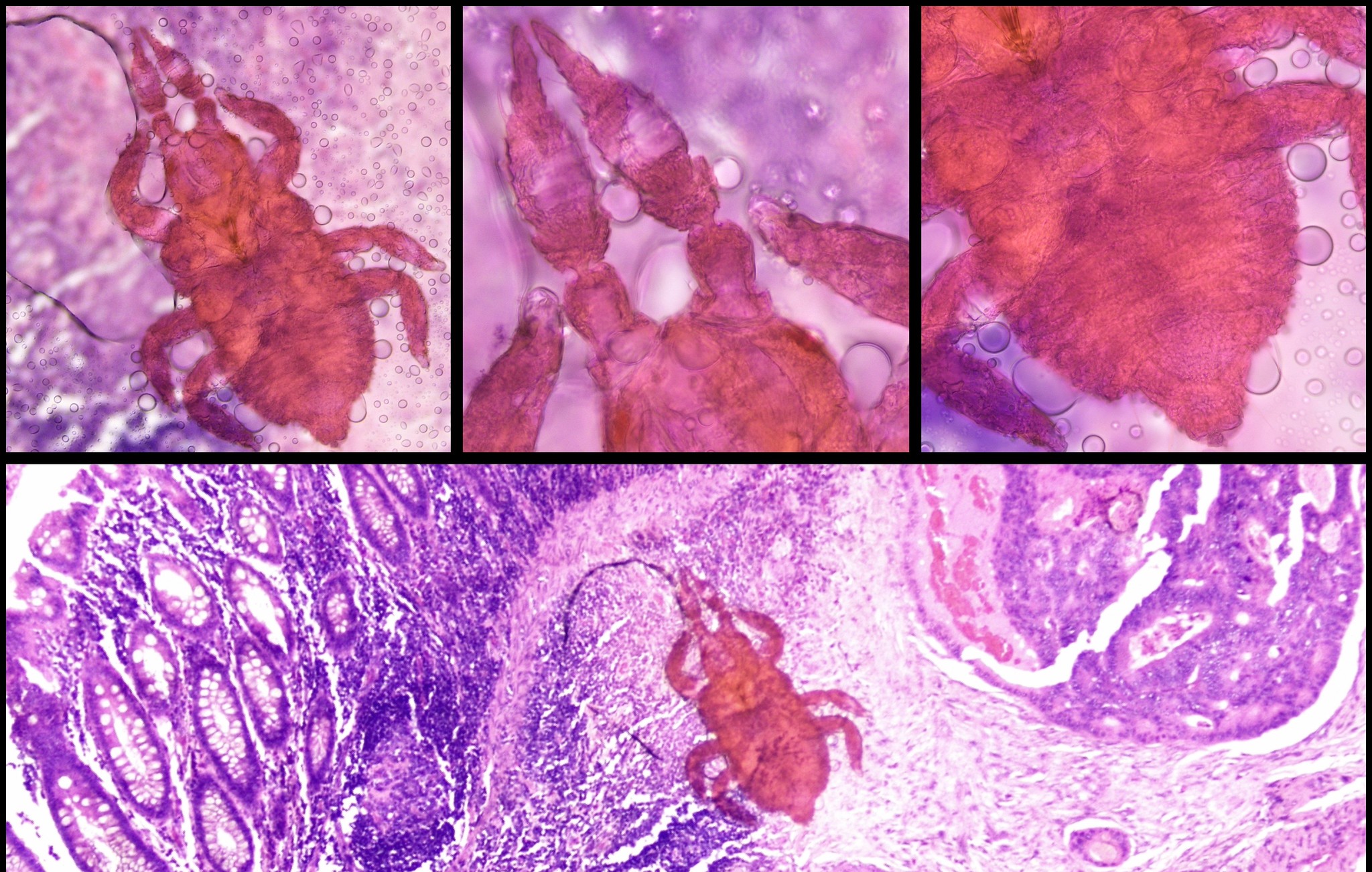 Small unknown insect on histological slide