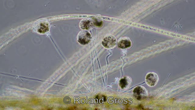Glockentier / Peritricha (Vorticella sp.) (microscope, magnification 100x Phase Contrast, video)