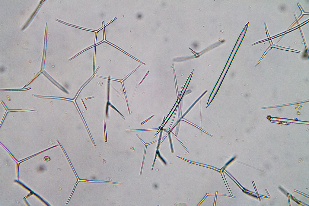 Spickules Spicules Slide