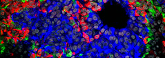 Endocrine cells differentiated from human embryonic stem cells