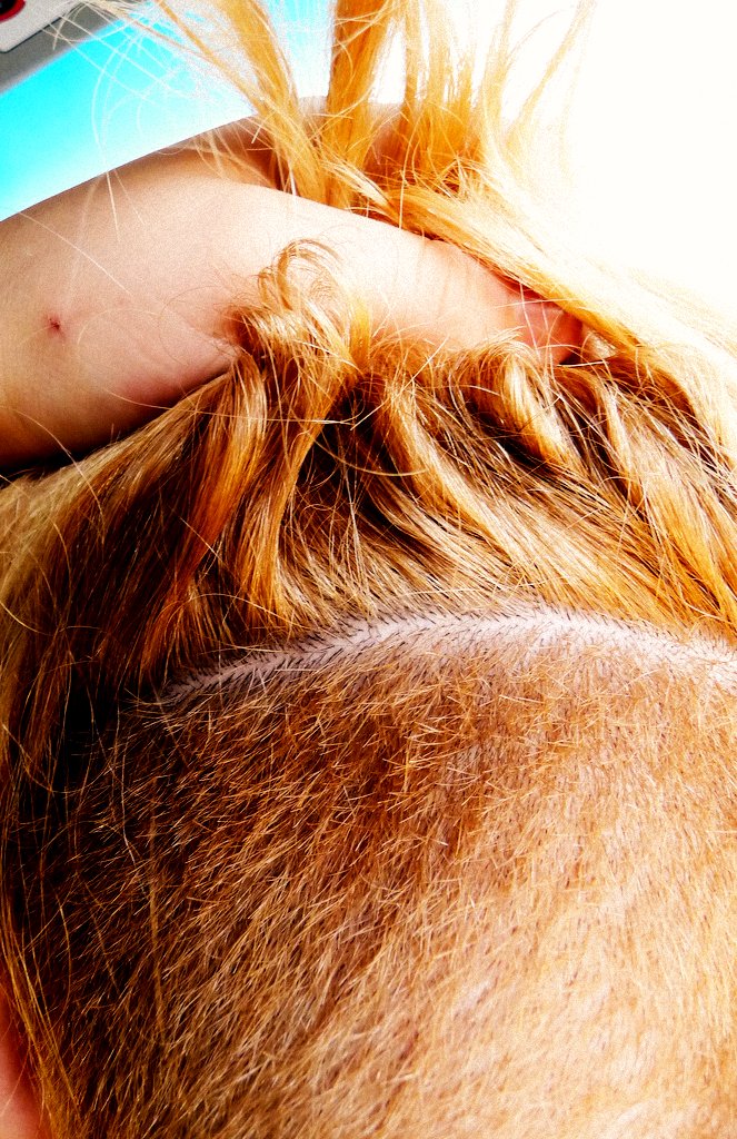 Close-up of a hair parting and scalp — hair by Alaska Carter, CC BY 2.0