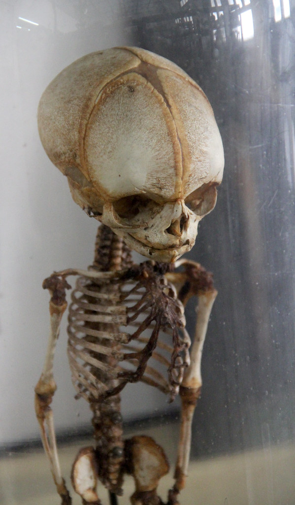 Fetal Skeleton, detail | At the incredible Congdon Anatomica… | Flickr