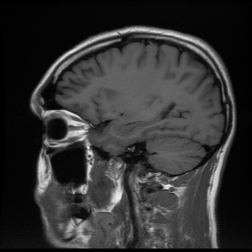 Scan_03_17 | MRI Head Scan - May 2012 | bucaorg (Paul Burnett) | Flickr