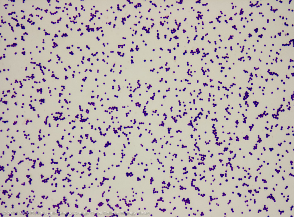 staphylococcus epidermidis gram stain