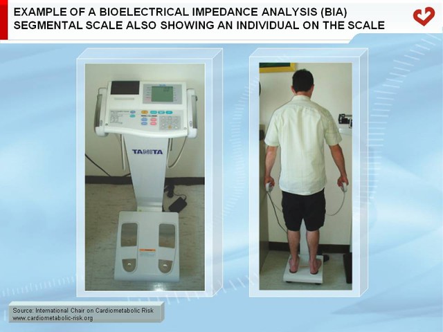 Example of a bioelectrical impedance analysis (BIA) segmen…