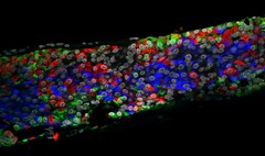 Encapsulated pancreatic cells differentiated from human embryonic stem cells