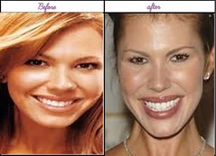Look At After Before Plastic Surgery Pictures Of Nikki Cox Was She Greater Before?