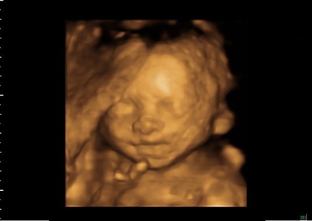 24 Weeks Baby In 3d Ultrasound 24 Weeks Baby Image In 3d U Flickr