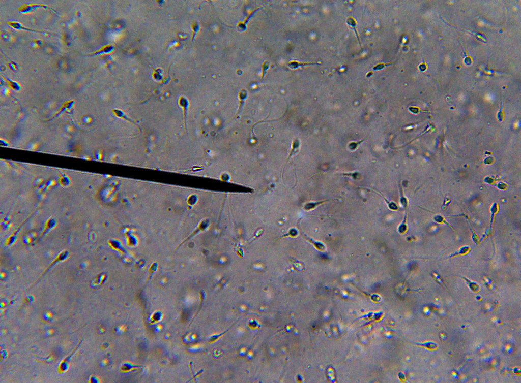 Sperm cells 400x