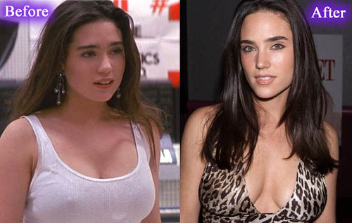Jennifer Connelly Breast Reduction.