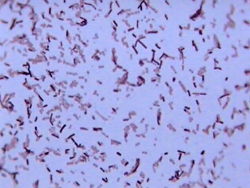 Bacterius C | canadianpond.ca/produits/water-treatments-en/b… | Flickr