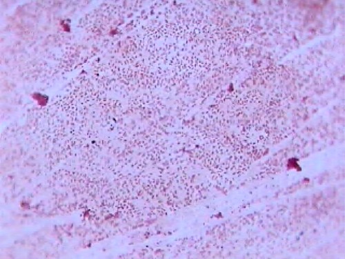 Bacterius N | canadianpond.ca/produits/water-treatments-en/b… | Flickr