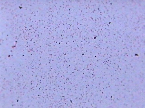 Bacterius N | canadianpond.ca/produits/water-treatments-en/b… | Flickr