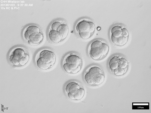 PHOTO N - Early stage human SCNT embryos - day 2