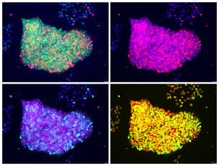 Genetically Engineered Fluorescent Induced Pluripotent Stem Cells (iPSC) | by NIAMS NIH