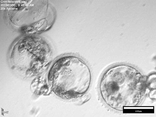 PHOTO Q - Human SCNT blastocysts