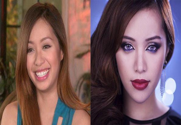 Michelle-Phan-Plastic-Surgery-Before-and-After | Michelle Ph… | Flickr