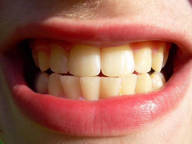 tooth - teeth