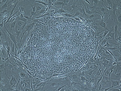 PHOTO W - Stem cell colony developed through SCNT