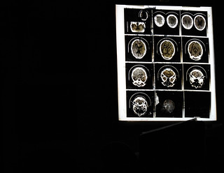 brain scan. | by adriosounds